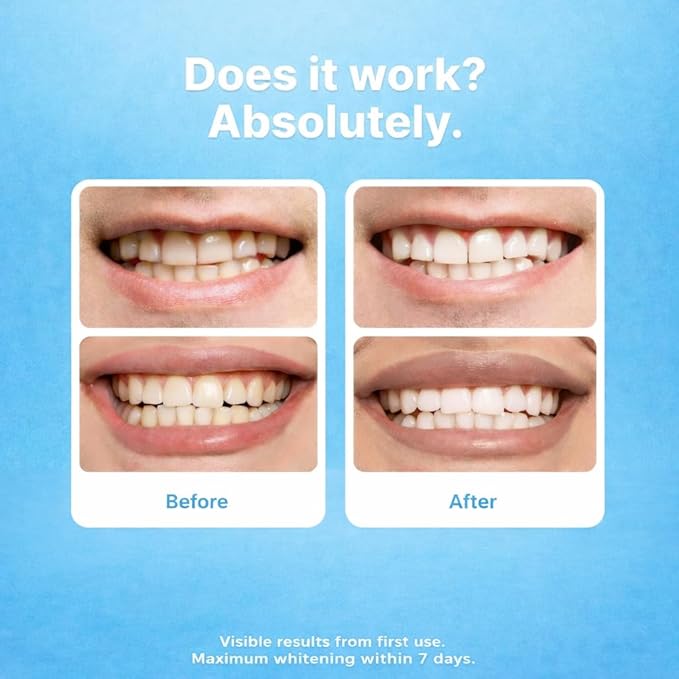 Jumu’ah Teeth Whitening Pens, Certified Non-Toxic, Enamel Safe - NO Sensitivity - Oral Care Teeth Whitener Pen, Vegan & Gentle on Teeth Professional Stain Removal (Pack of 3)