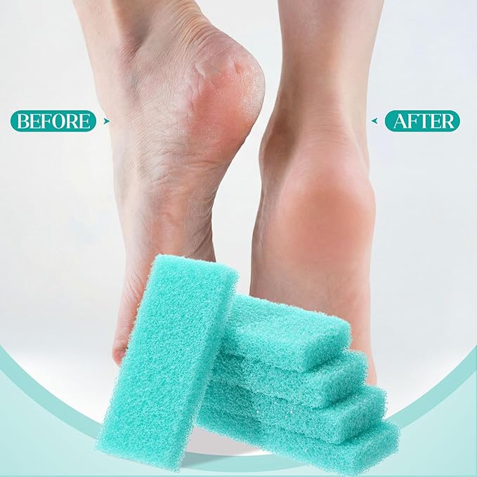 Batiyeer 300 Pcs Pumice Stone Bulk for Feet Scrubber Dead Skin Disposable Foot Pumice Foot Shower Scrubber for Heel Cuticle Callus Remover Bath Spa (Sky Blue)
