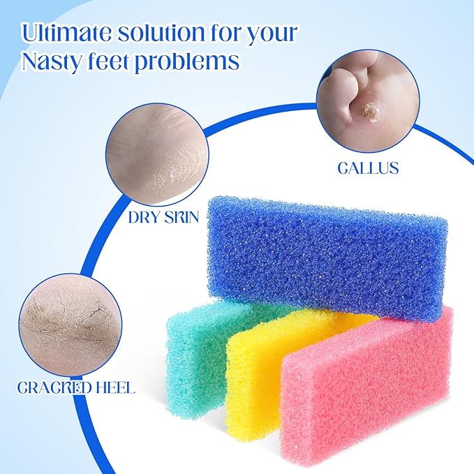 Batiyeer 300 Pcs Pumice Stone Bulk for Feet Scrubber Dead Skin Disposable Foot Pumice Foot Shower Scrubber for Heel Cuticle Callus Remover Bath Spa (Blue, Sky Blue, Pink, Yellow)