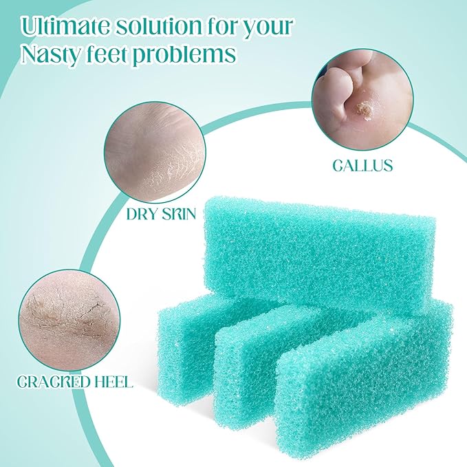 Batiyeer 300 Pcs Pumice Stone Bulk for Feet Scrubber Dead Skin Disposable Foot Pumice Foot Shower Scrubber for Heel Cuticle Callus Remover Bath Spa (Sky Blue)